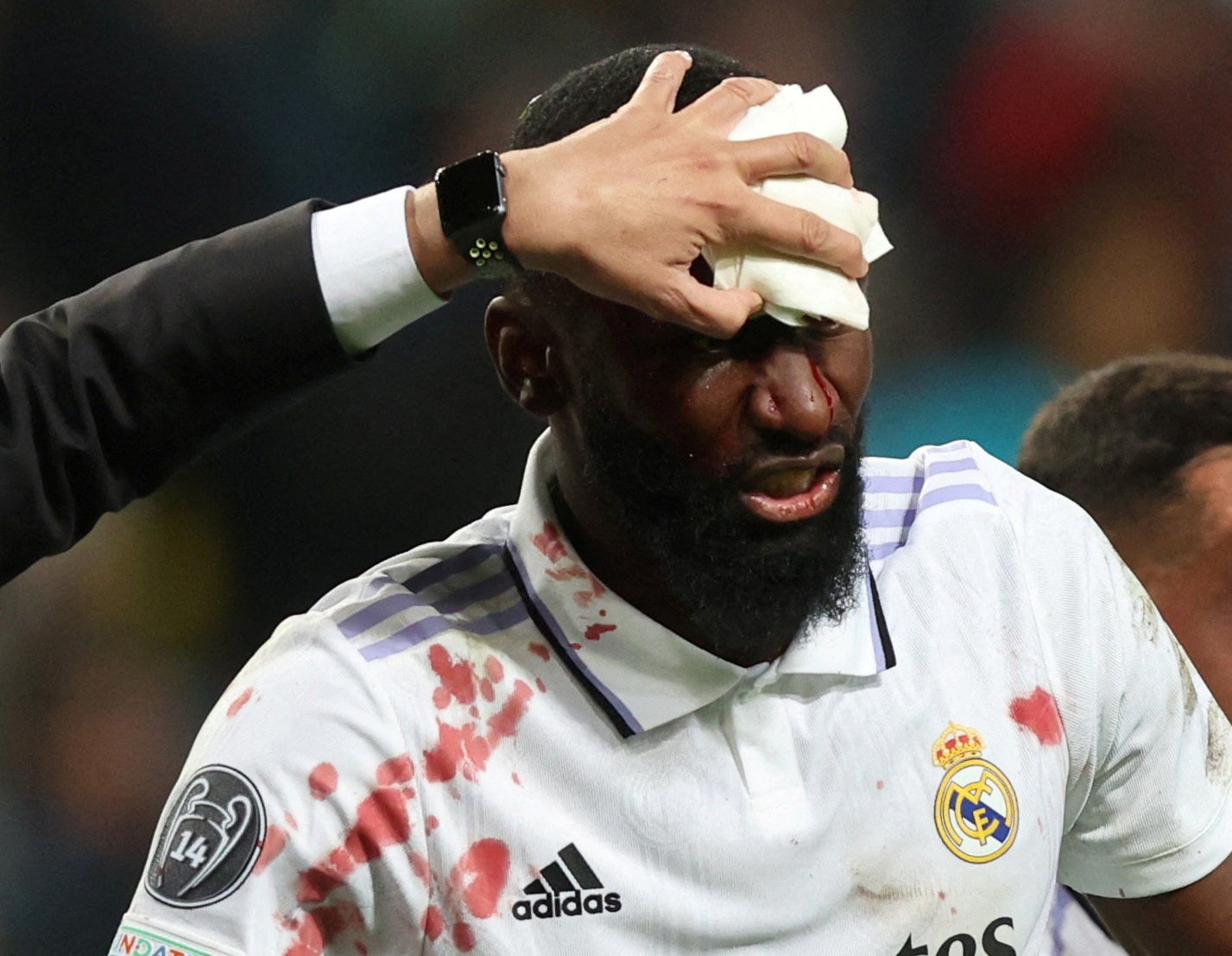 Carlo Ancelotti gives update on Courtois and Rudiger injury.